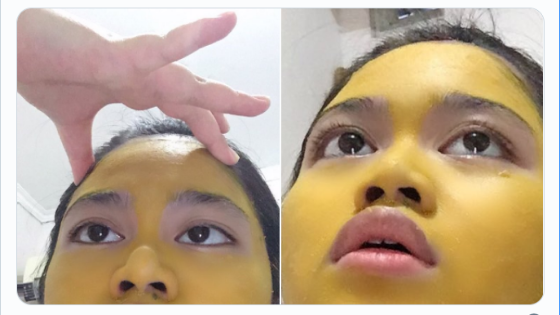 Wanita Ini Guna Kunyit Buat Topeng Muka Tapi 'Warna Kuning' Tak Hilang, Ini Jadinya!