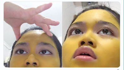 Wanita Ini Guna Kunyit Buat Topeng Muka Tapi 'Warna Kuning' Tak Hilang, Ini Jadinya!