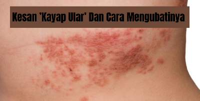 Kayap Ular Boleh Bawa Maut? Ini Penjelasannya