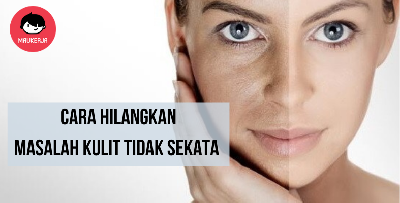 Muka Korang Kusam? Doktor Kongsi Cara Penjagaan Supaya Tona Kulit Sekata