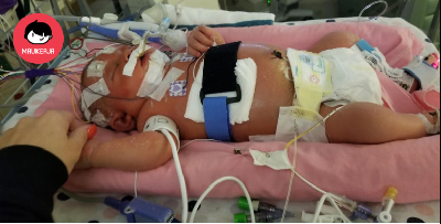 Bayi 18 Hari Maut, Dijangkiti Virus 2 Jam Selepas Dicium Saudara
