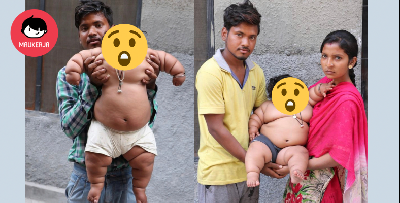 Umur Baru 2 Tahun Tapi Berat Cecah 23 KG. Doktor Terkejut Rupanya..