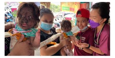 Uniknya, bayi ni dilahirkan berbulu tetapi kelihatan sangat comel